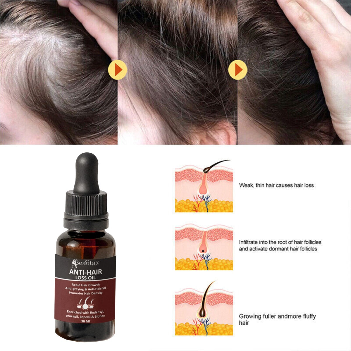 PureGrow Anti Hair Oil