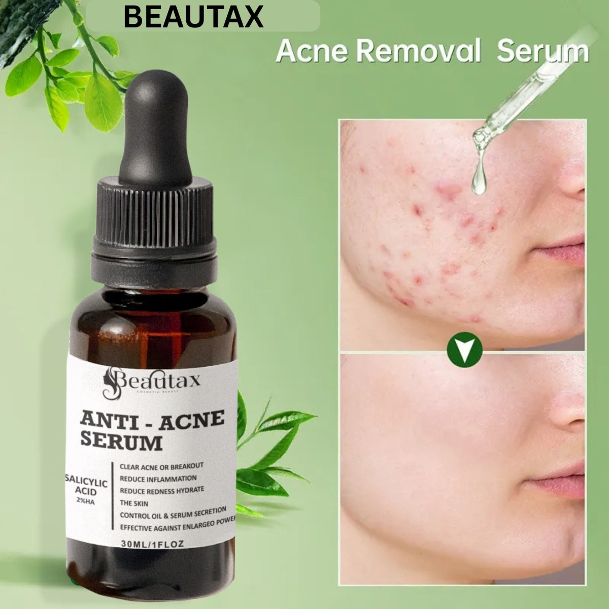 GlowClear Acne Solution